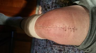 15799938_10211478235782225_924200078159804551_o